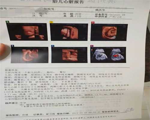 上海有代孕医院吗：单脐动脉畸形_常州助孕保健