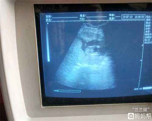 上海地下代孕市场代怀孕早期双胞胎的症状与单
