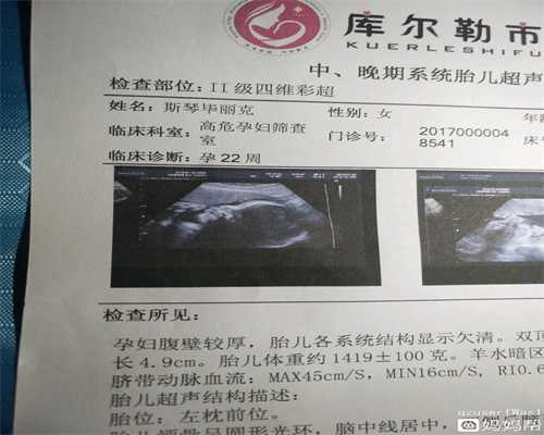 上海晴天助孕代孕妈妈们都是勇士！脚肿成猪蹄