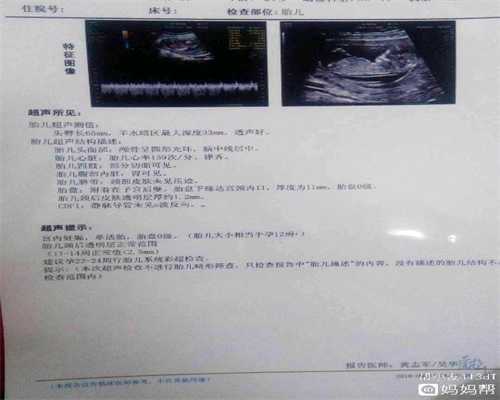 上海代孕价格甲状腺结节患者可以代怀孕吗？