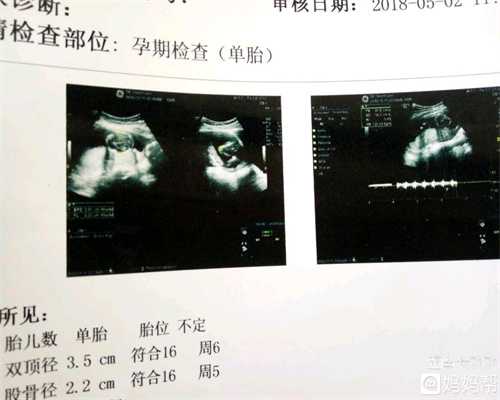 上海代孕价格多少代孕妇能不能吃雄鸡？代孕妇