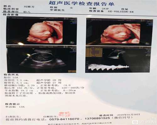上海代孕价格表从排卵到代孕需要几天？若你出