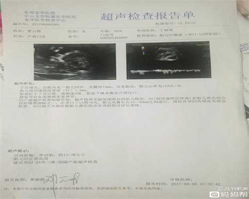上海代孕费用多少钱：广州哪里有卖门诊用的B超
