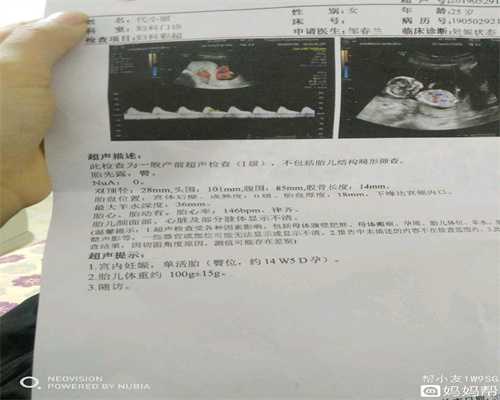 上海福康助孕怎么样：孕妇冬天可以烤火吗？孕