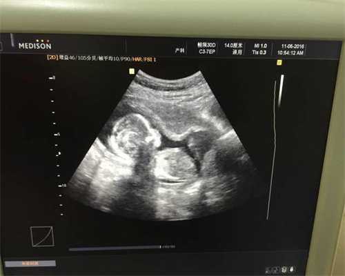 深圳代孕:做试管婴儿前哪些需要必须检查一下