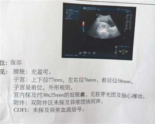 上海有帮着代孕的·上海第三代试管婴儿选性别