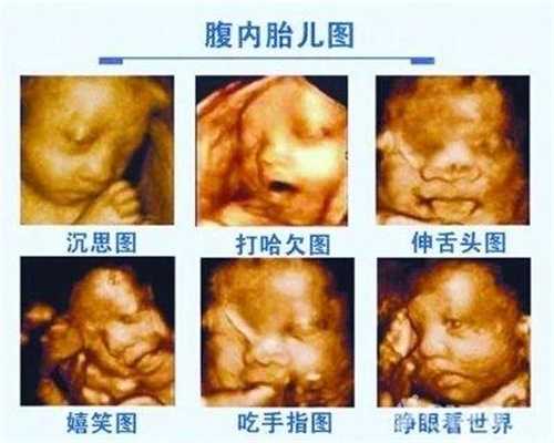 许昌代孕机构 ，到哪找代孕，代孕后这4种水代孕